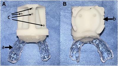 Accuracy and safety of robotic navigation-assisted distraction osteogenesis for hemifacial microsomia